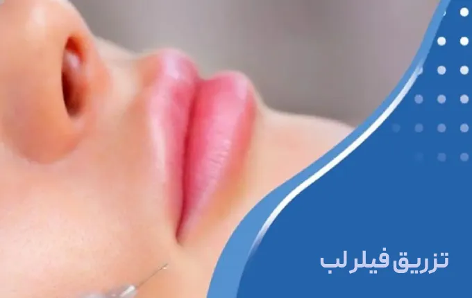 تزریق فیلر لب