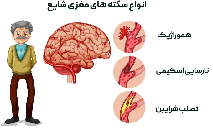 انواع سکته مغزی